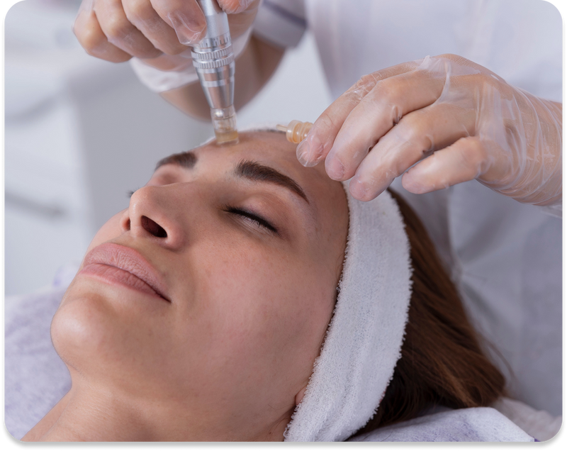 <p>Multiple microneedling sessions for minimally invasive facial rejuvenation: an objective assessment</p>