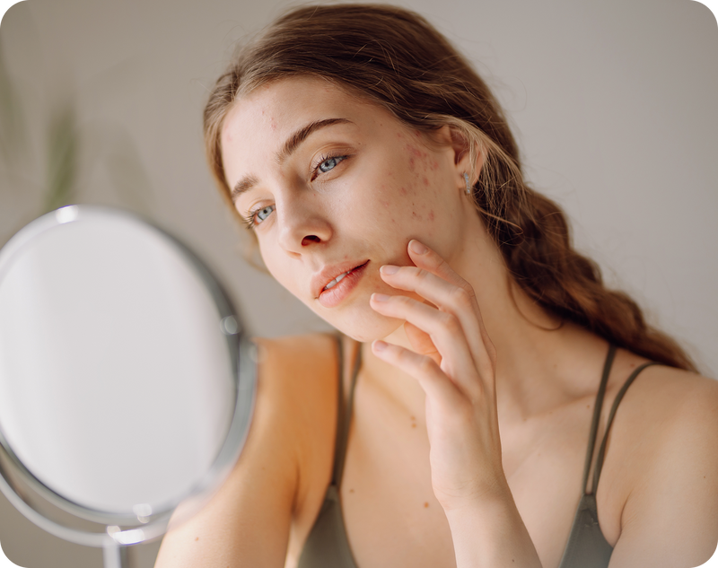 <p>Percutaneous Collagen Induction Therapy: An Alternative Treatment for Scars, Wrinkles, and Skin Laxity</p>